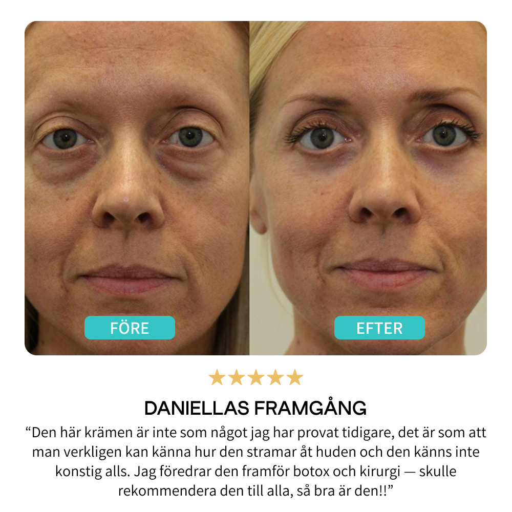 BrightUp - Øjeblikkelig Eye Tightener