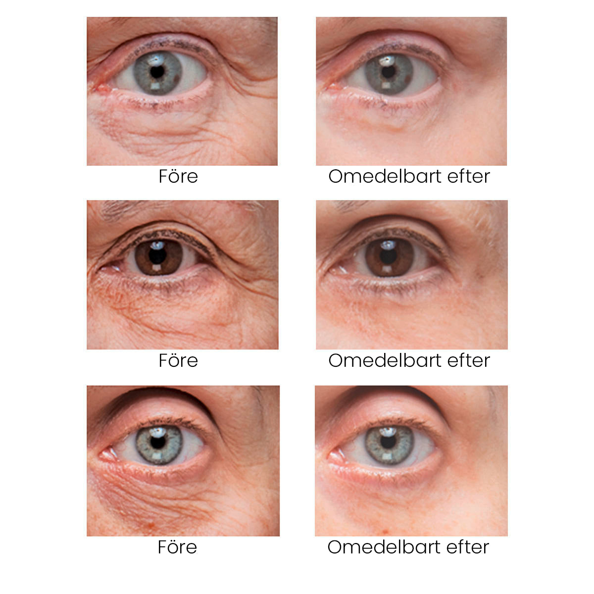 BrightUp - Omedelbar Eye Tightener