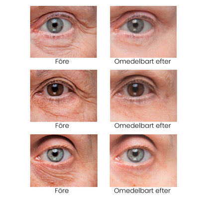 BrightUp - Omedelbar Eye Tightener