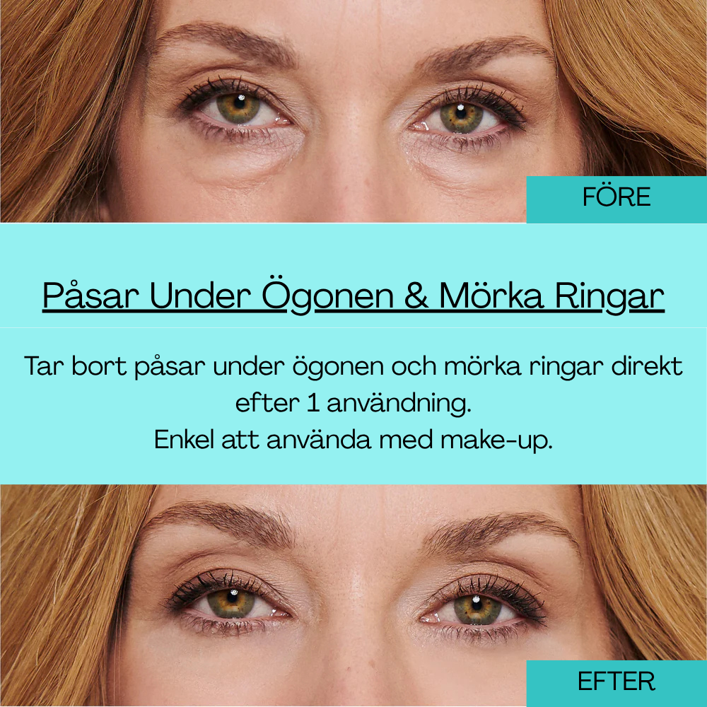 BrightUp - Omedelbar Eye Tightener