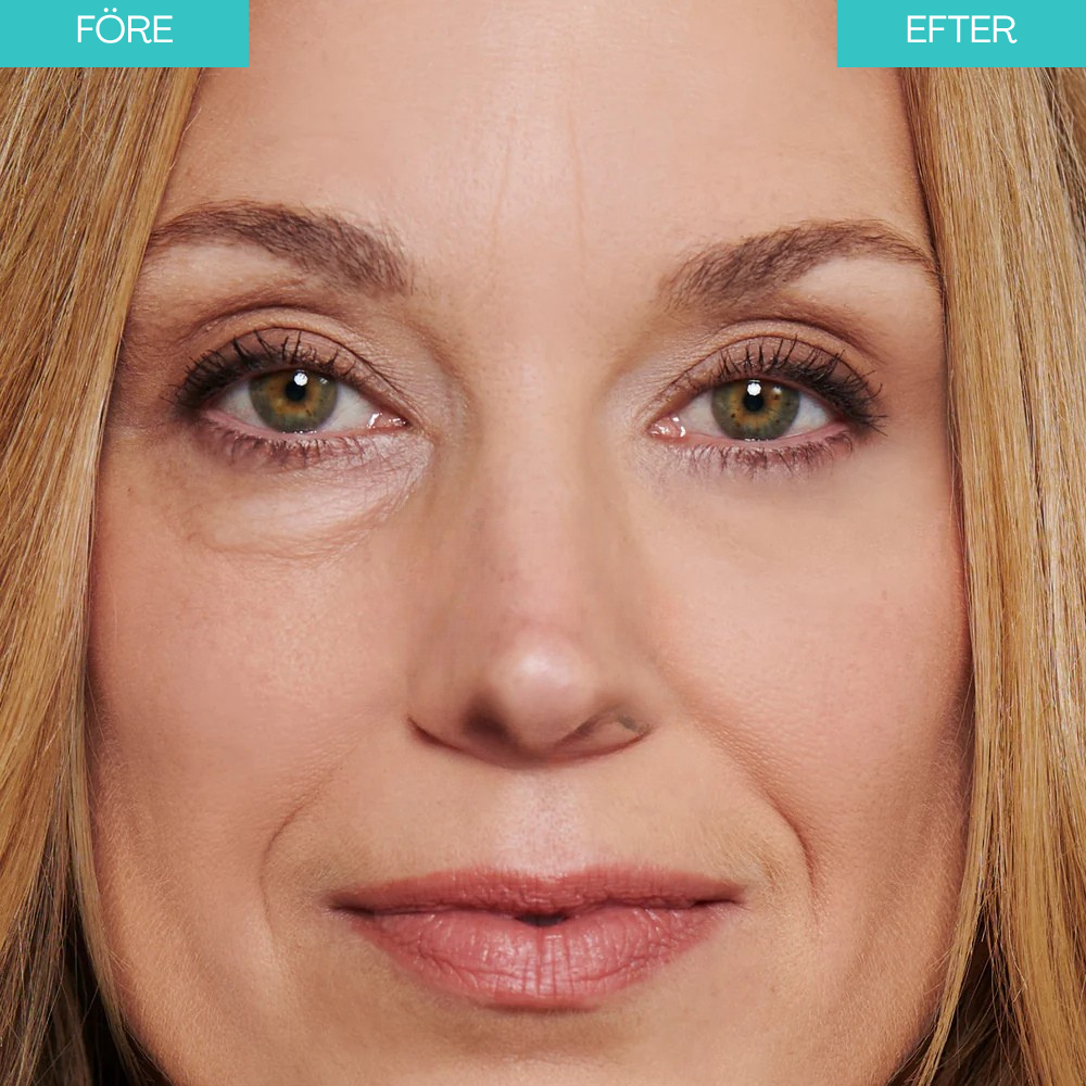 BrightUp - Omedelbar Eye Tightener