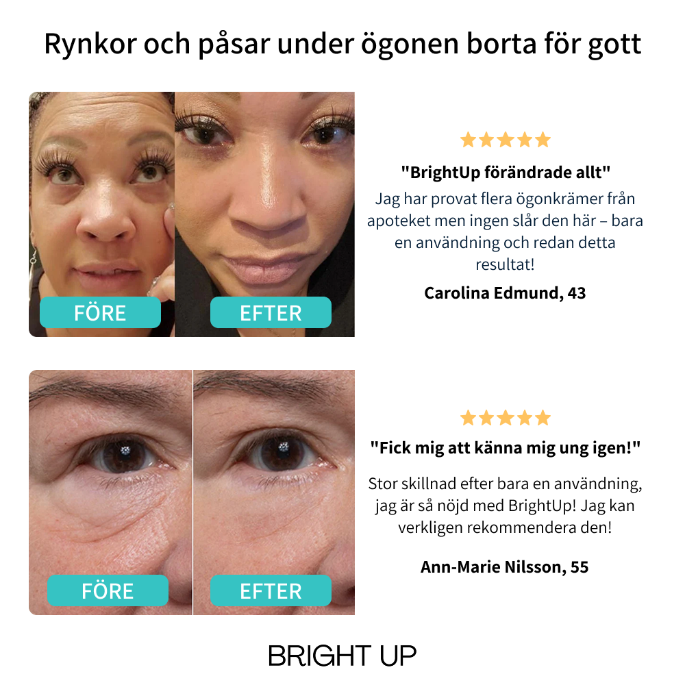 BrightUp - Øjeblikkelig Eye Tightener